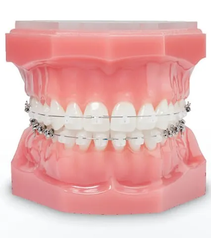 Dispositivo Damon clear