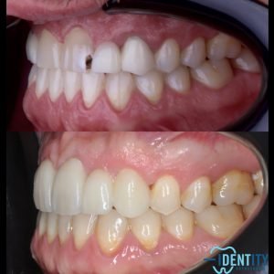 rehabilitacion estetica